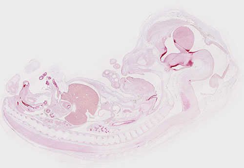 RNAscope data in a human embryo