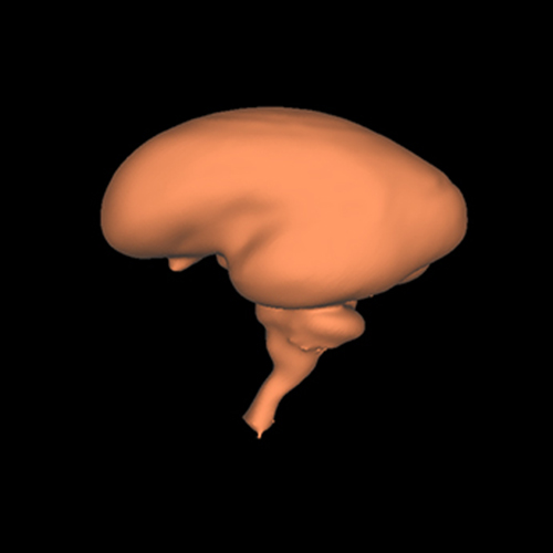 A 3D model of a human fetal brain