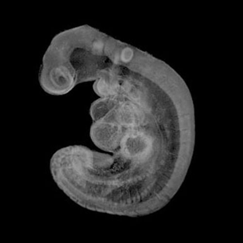 A 3D model of a human embryo