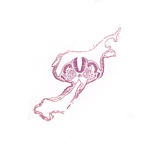 CS11 human embryo histology section