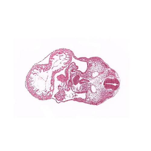 CS12 human embryo histology section