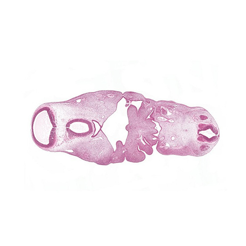 CS13 human embryo histology section