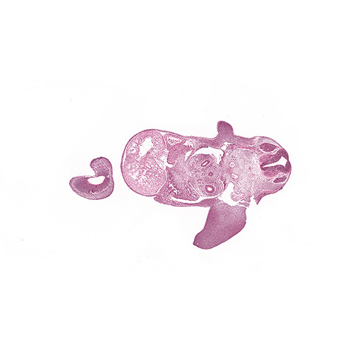 CS14 human embryo histology section