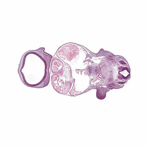 CS15 human embryo histology section