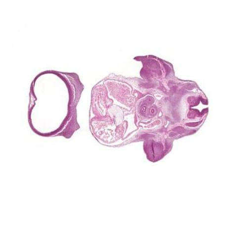 CS16 human embryo histology section