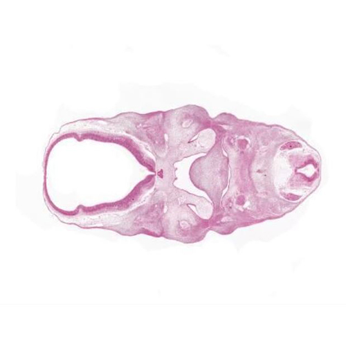 CS17 human embryo histology section