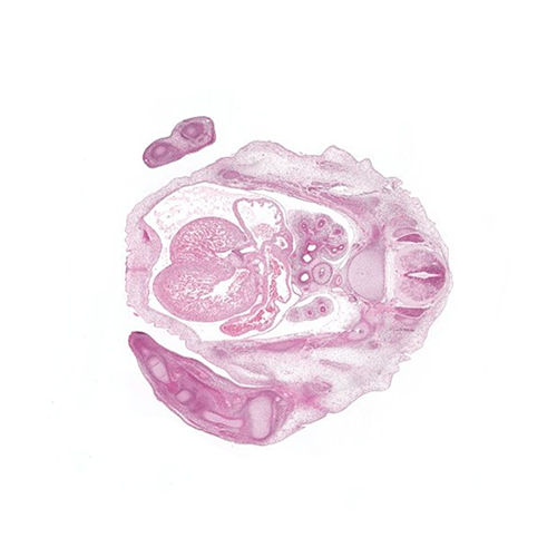 CS18 human embryo histology section