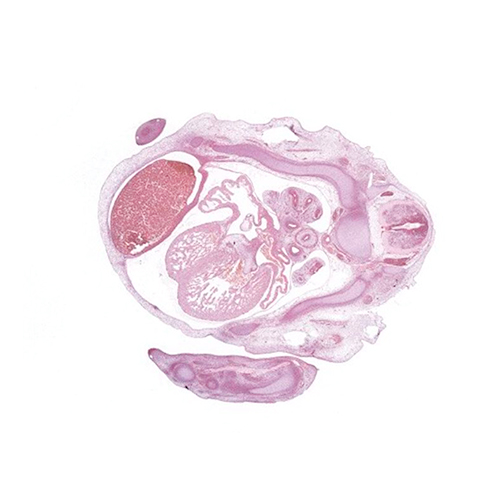 CS19 human embryo histology section