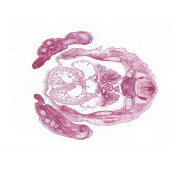 CS20 human embryo histology section