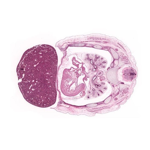 CS21 human embryo histology section