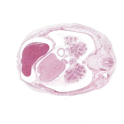 CS22 human embryo histology section