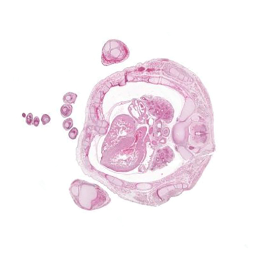 CS23 human embryo histology section
