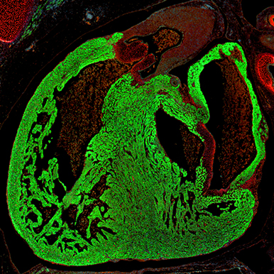 Section of a human embryonic heart