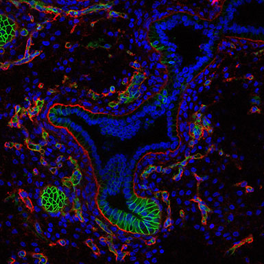 Section of a human embryonic heart
