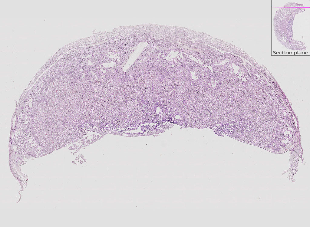 e14.5 mouse placenta