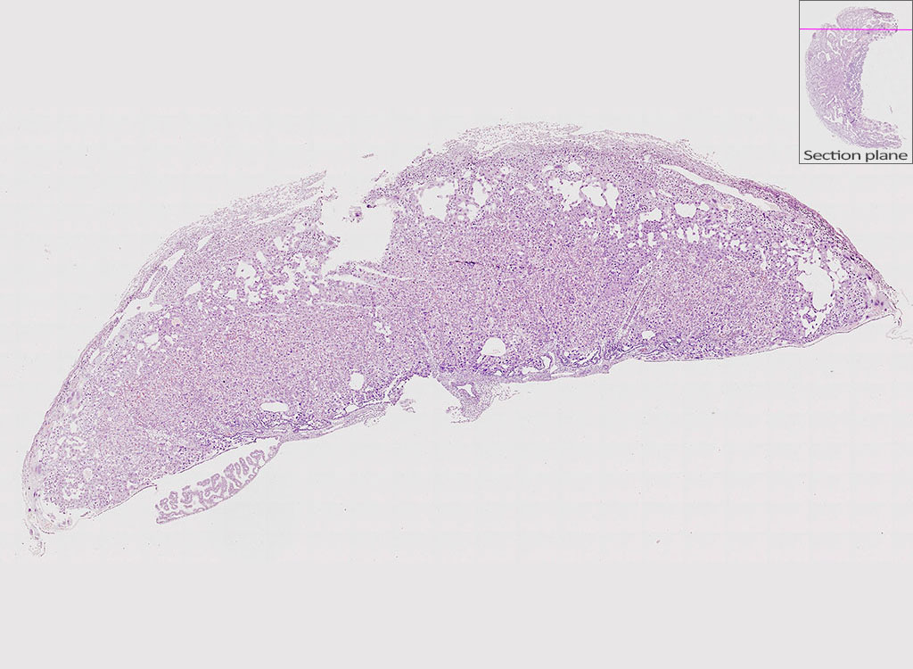 e14.5 mouse placenta