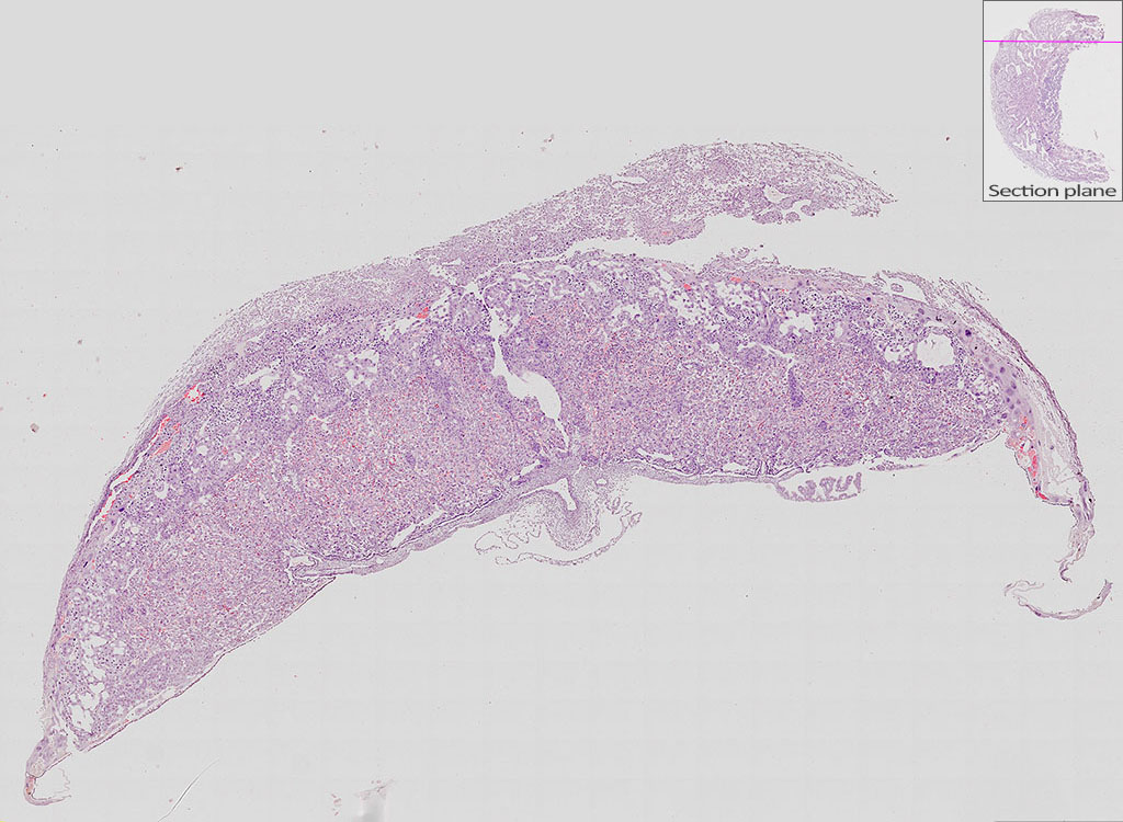 e14.5 mouse placenta