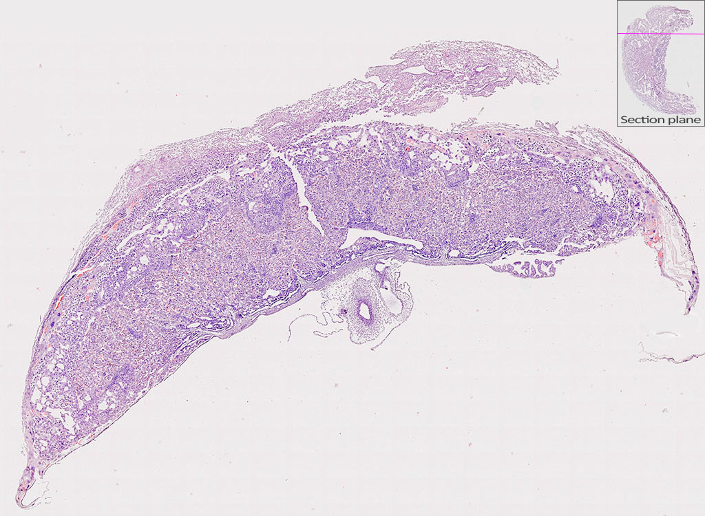 e14.5 mouse placenta