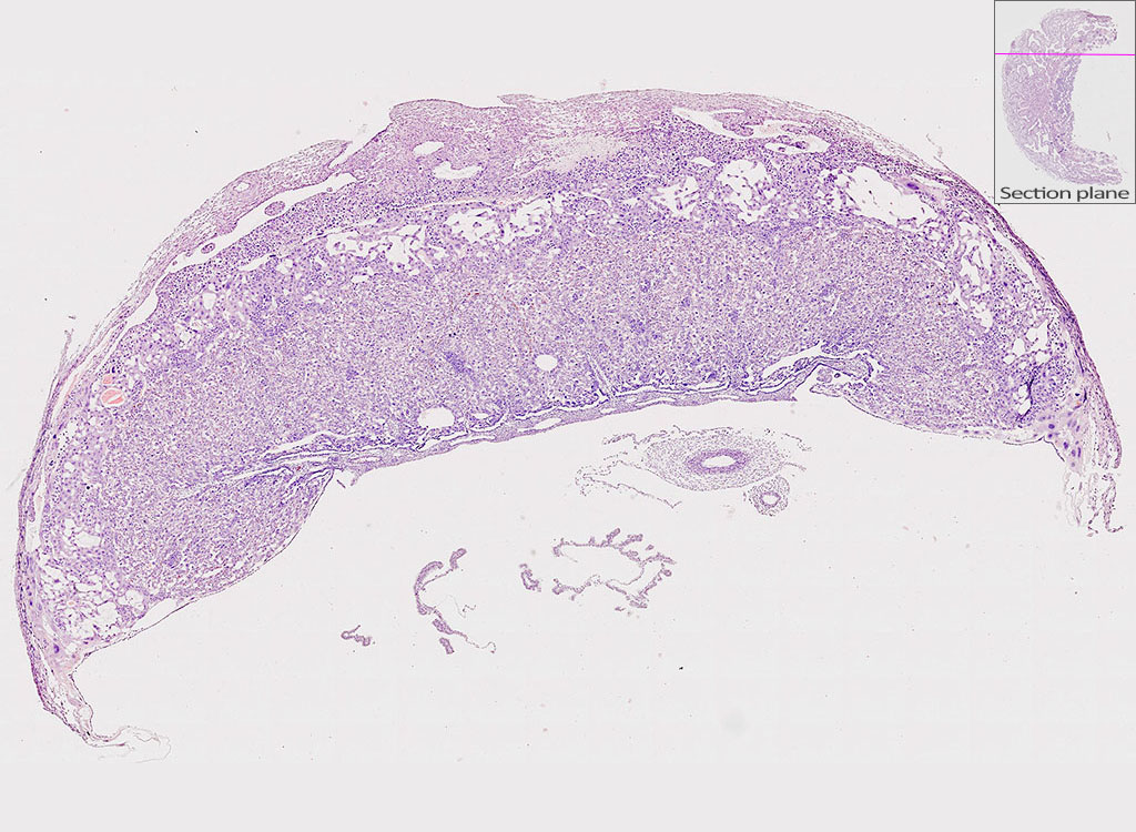 e14.5 mouse placenta