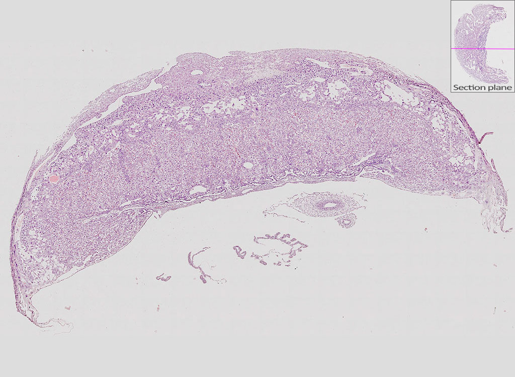 e14.5 mouse placenta