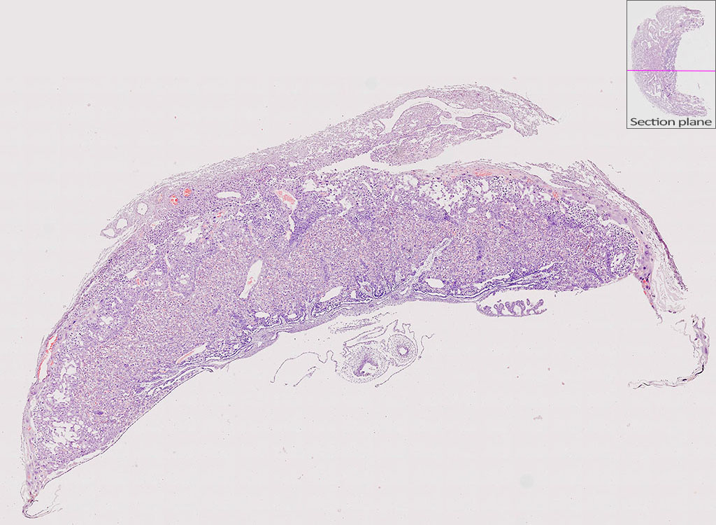 e14.5 mouse placenta