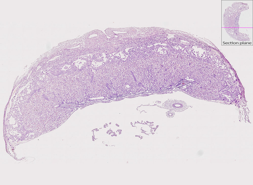 e14.5 mouse placenta