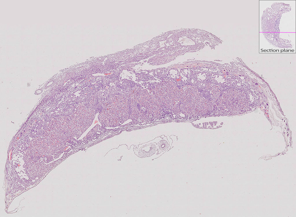 e14.5 mouse placenta