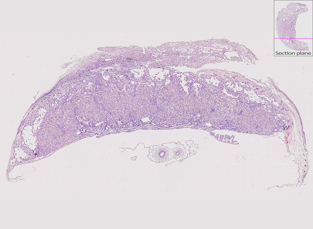 e14.5 mouse placenta