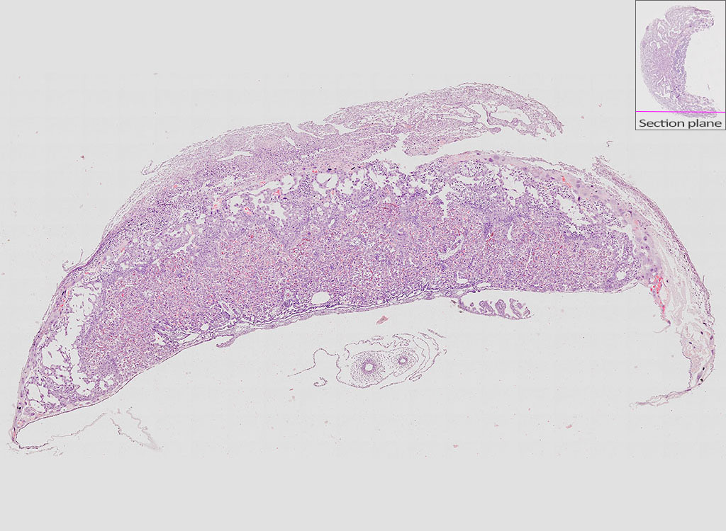 e14.5 mouse placenta