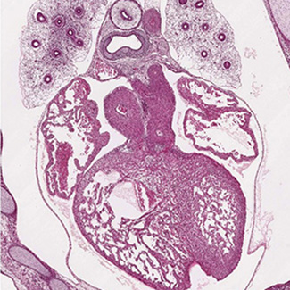 Histology section of a human embryonic heart