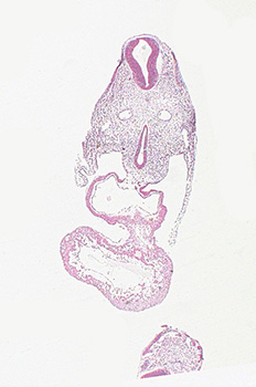 A histology section of a human embryo
