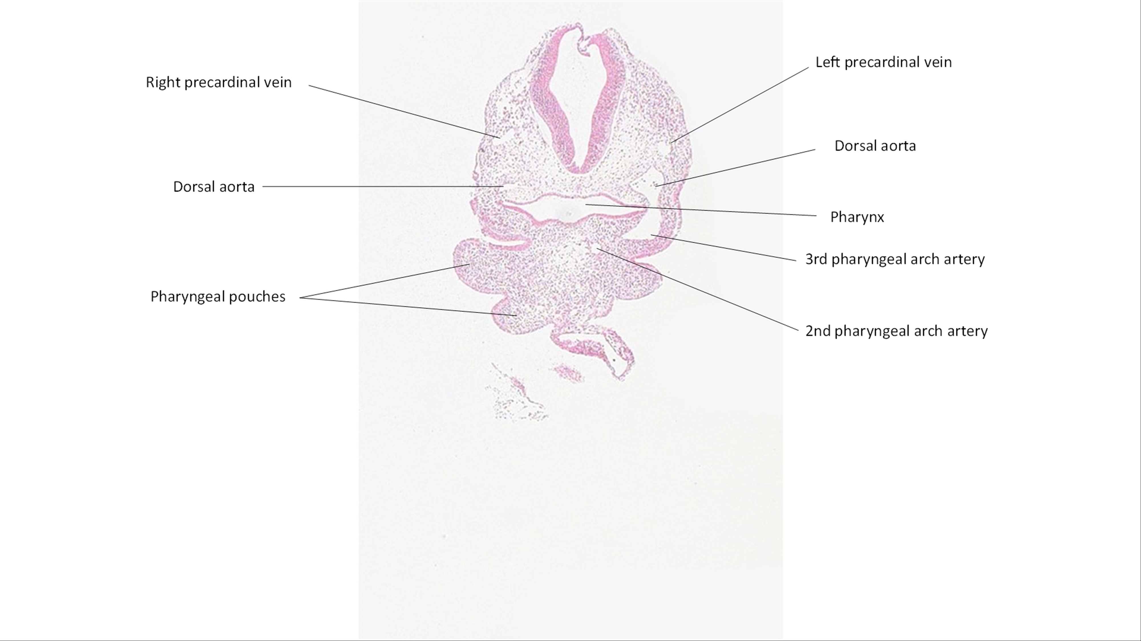 A histology section of a human embryo