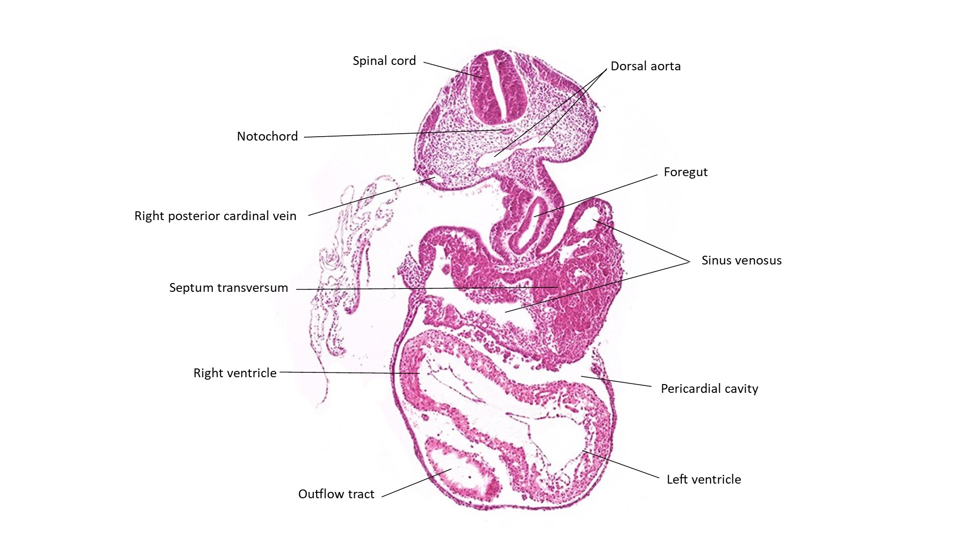 A histology section of a human embryo