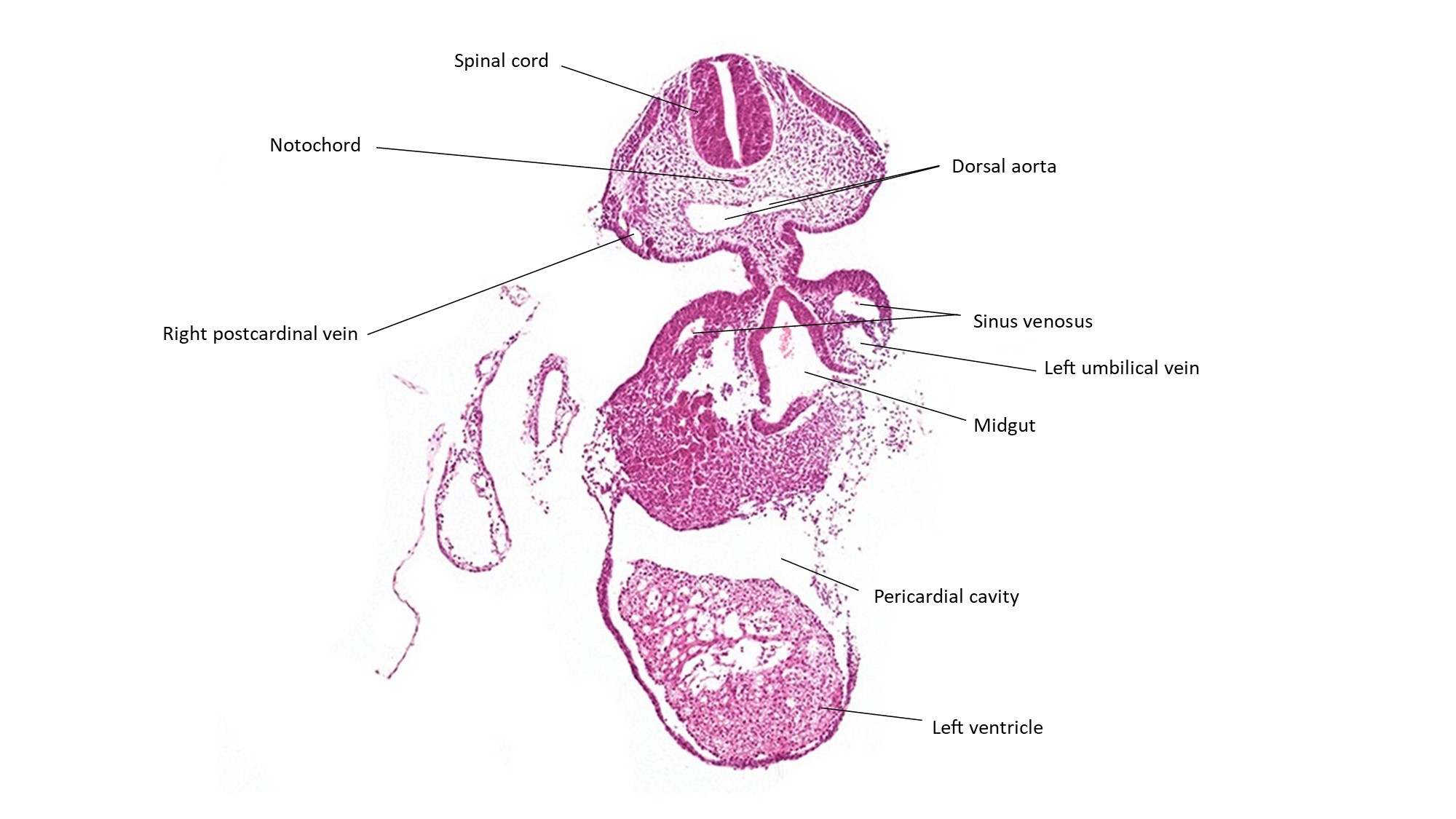 A histology section of a human embryo