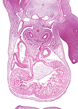 A histology section of a human embryo