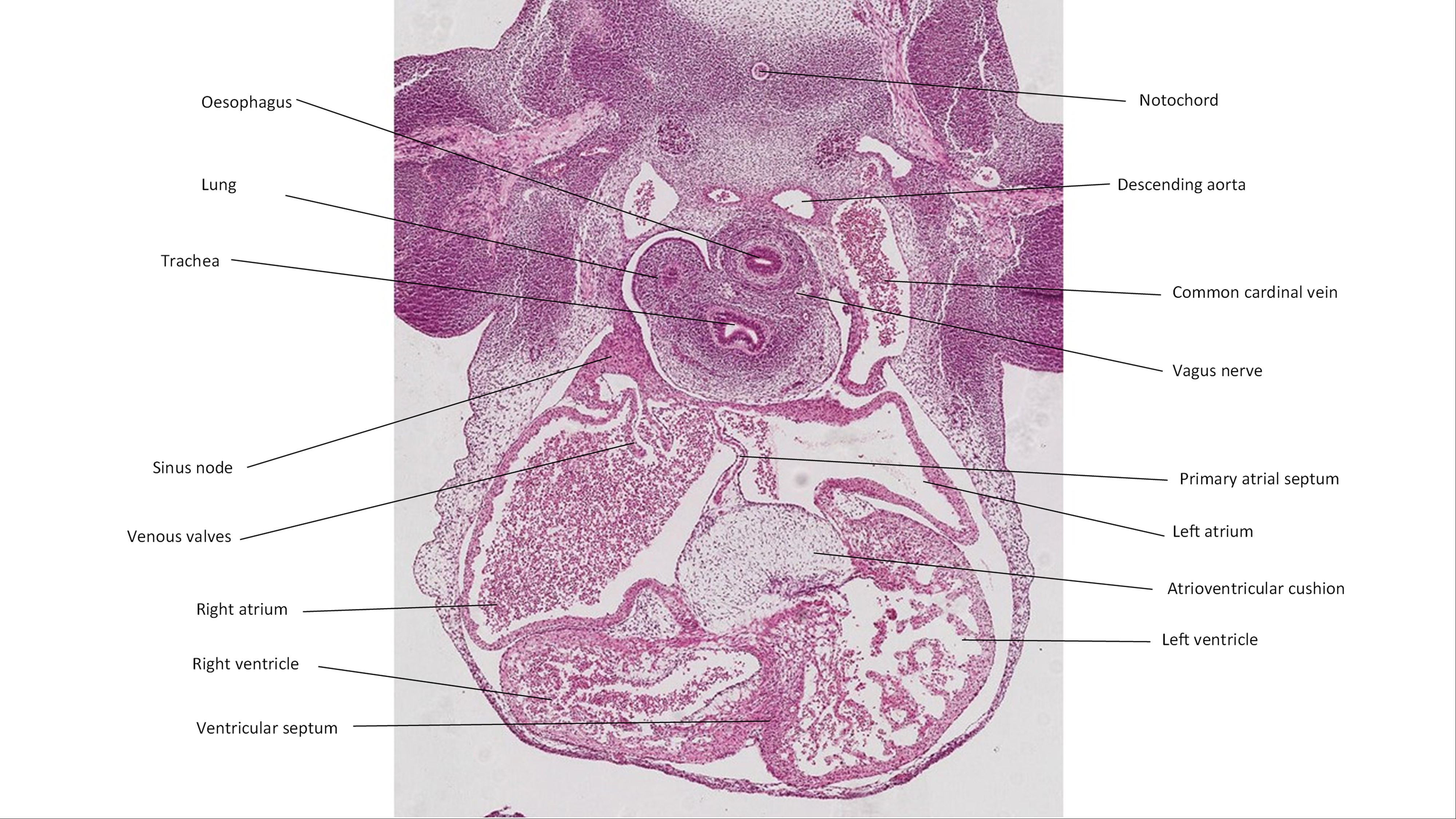 A histology section of a human embryo