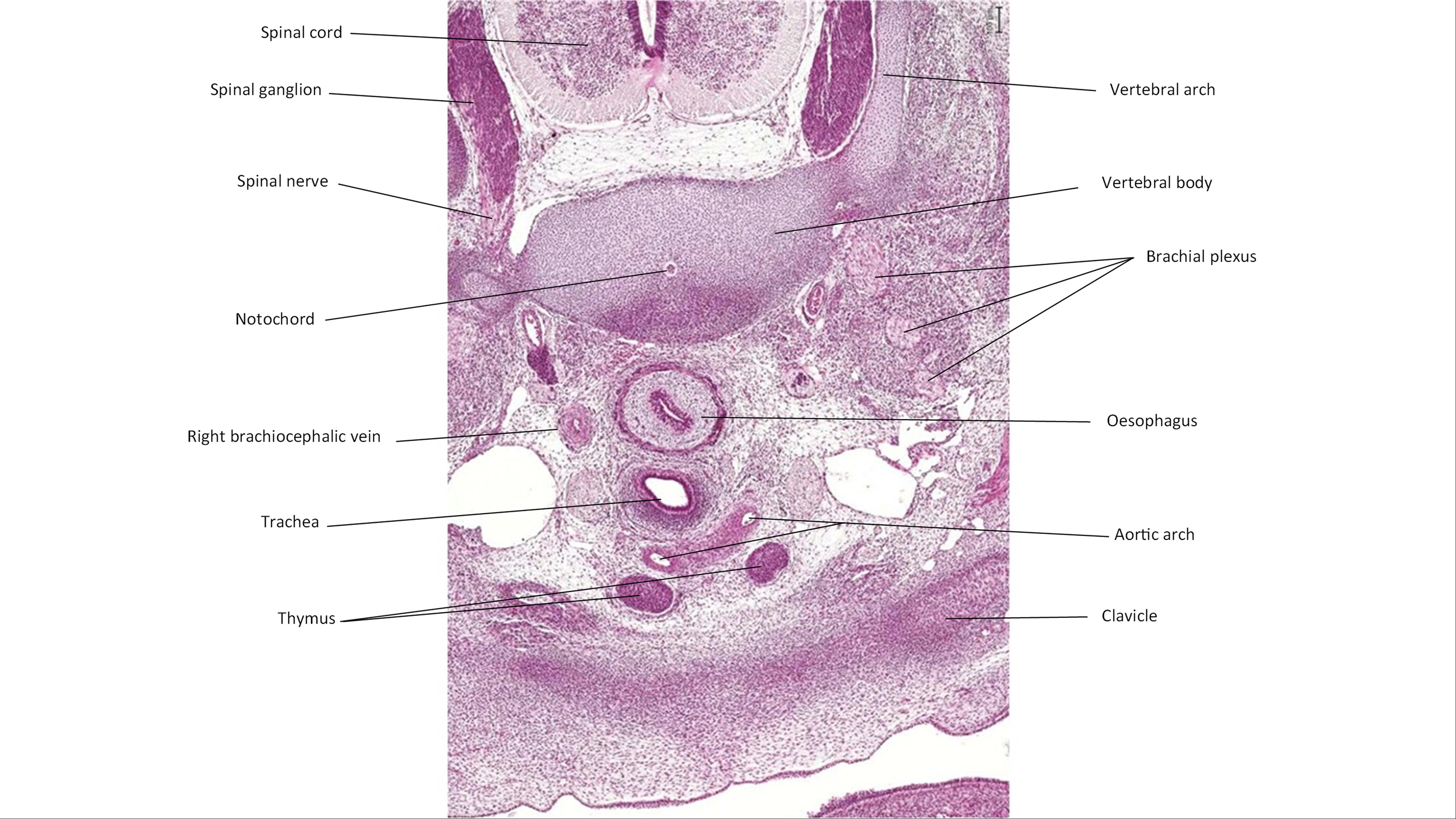 A histology section of a human embryo