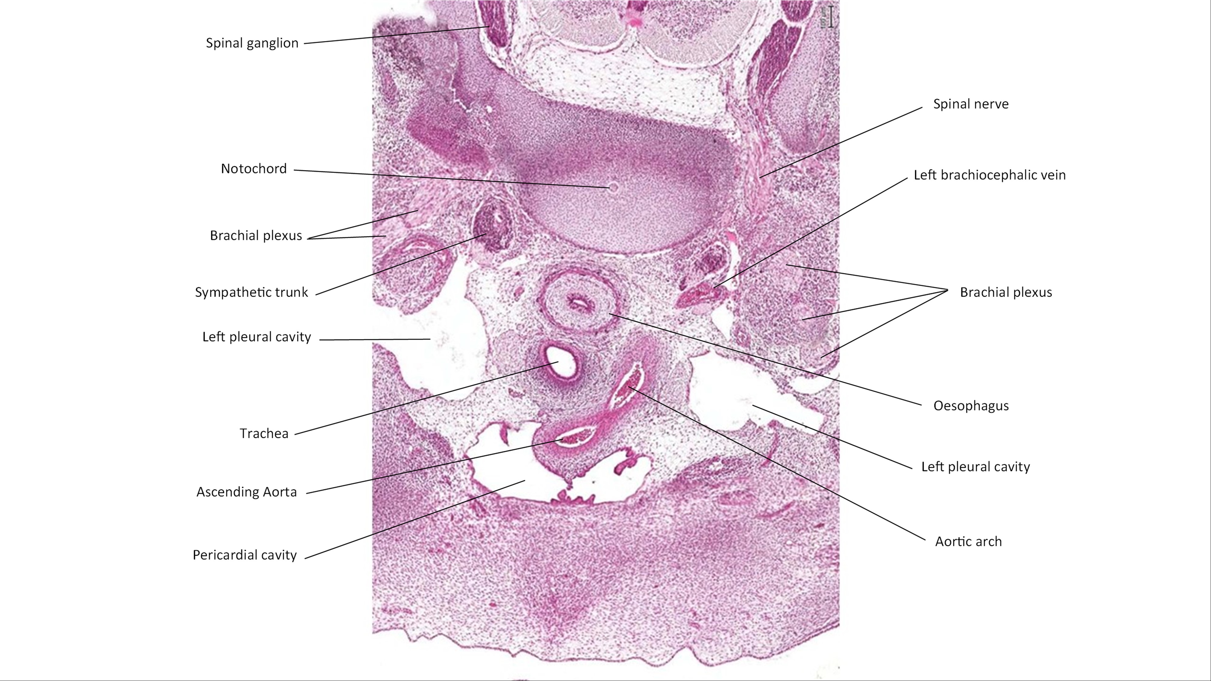 A histology section of a human embryo