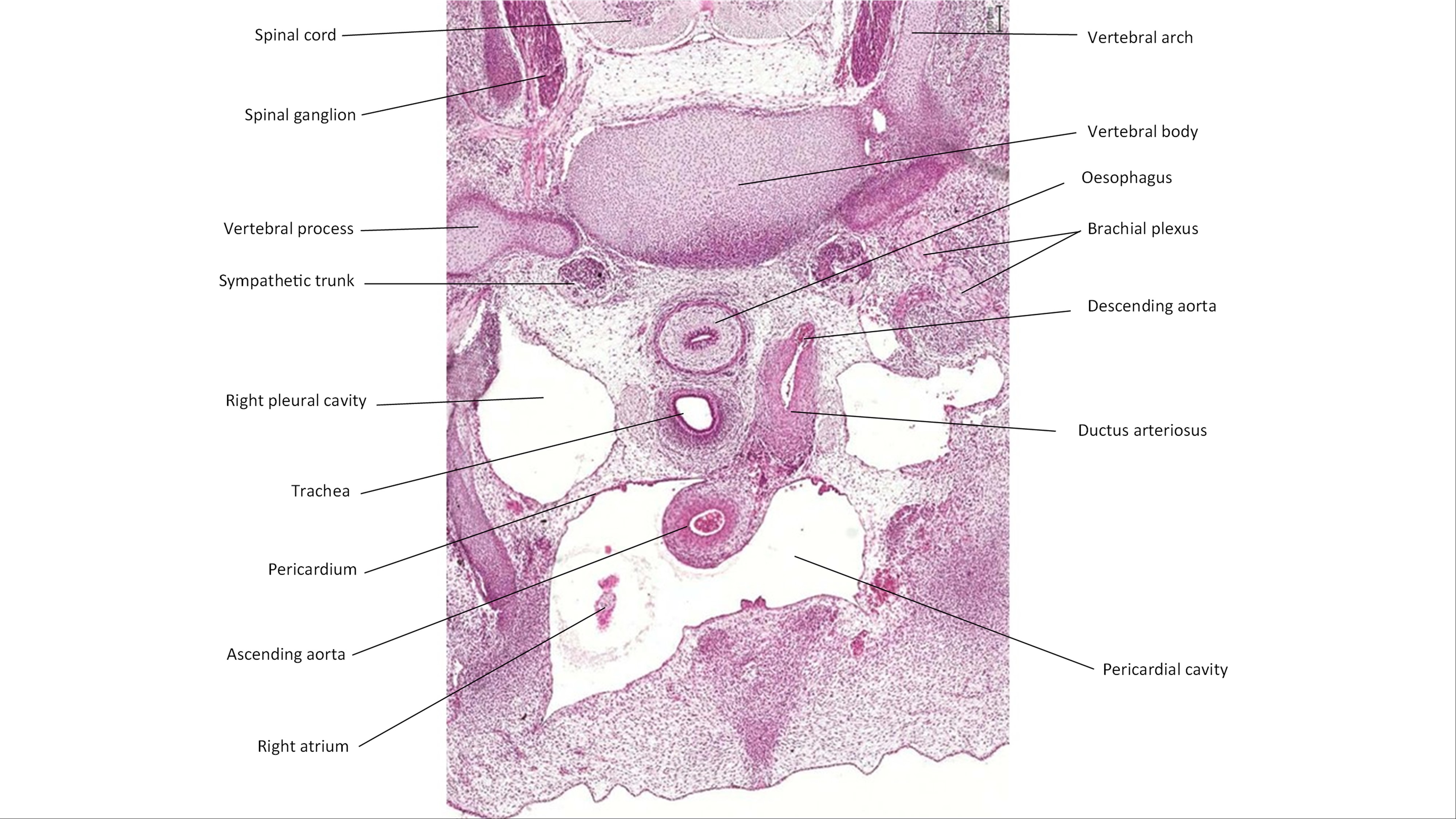 A histology section of a human embryo