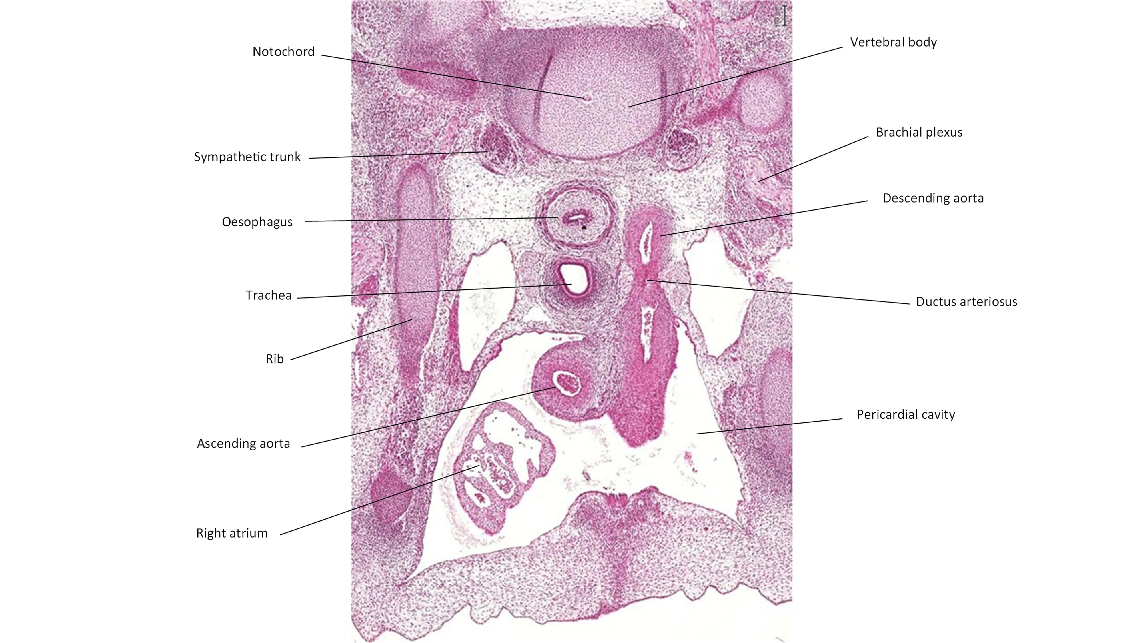 A histology section of a human embryo