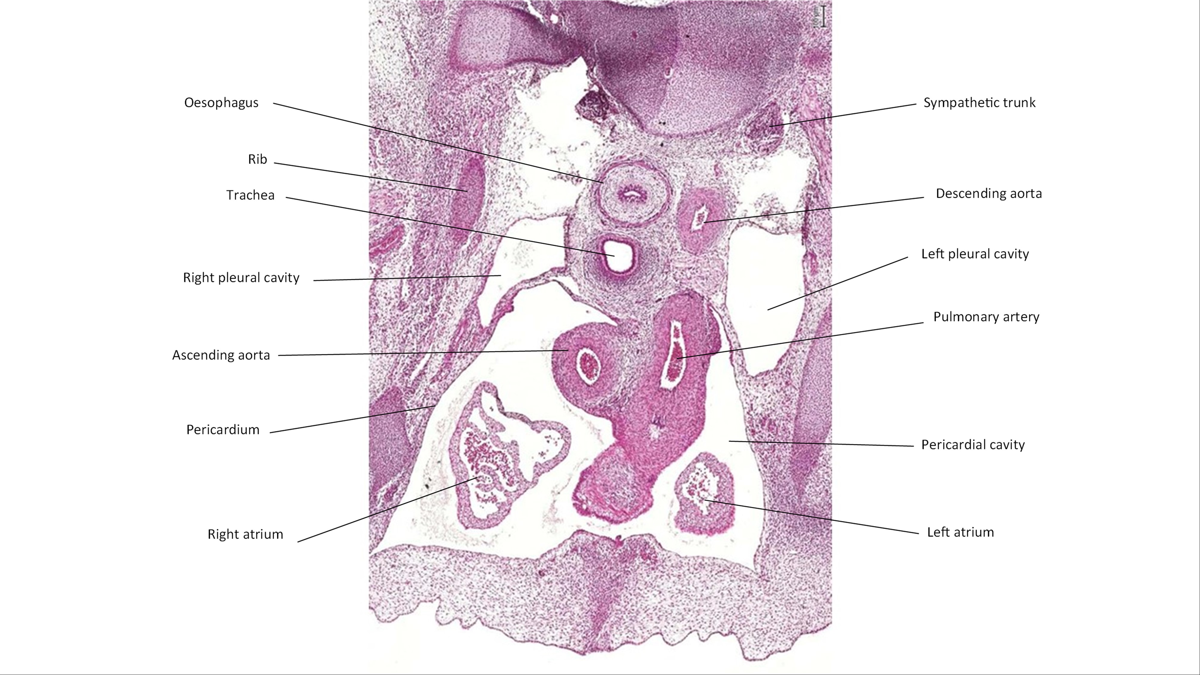 A histology section of a human embryo