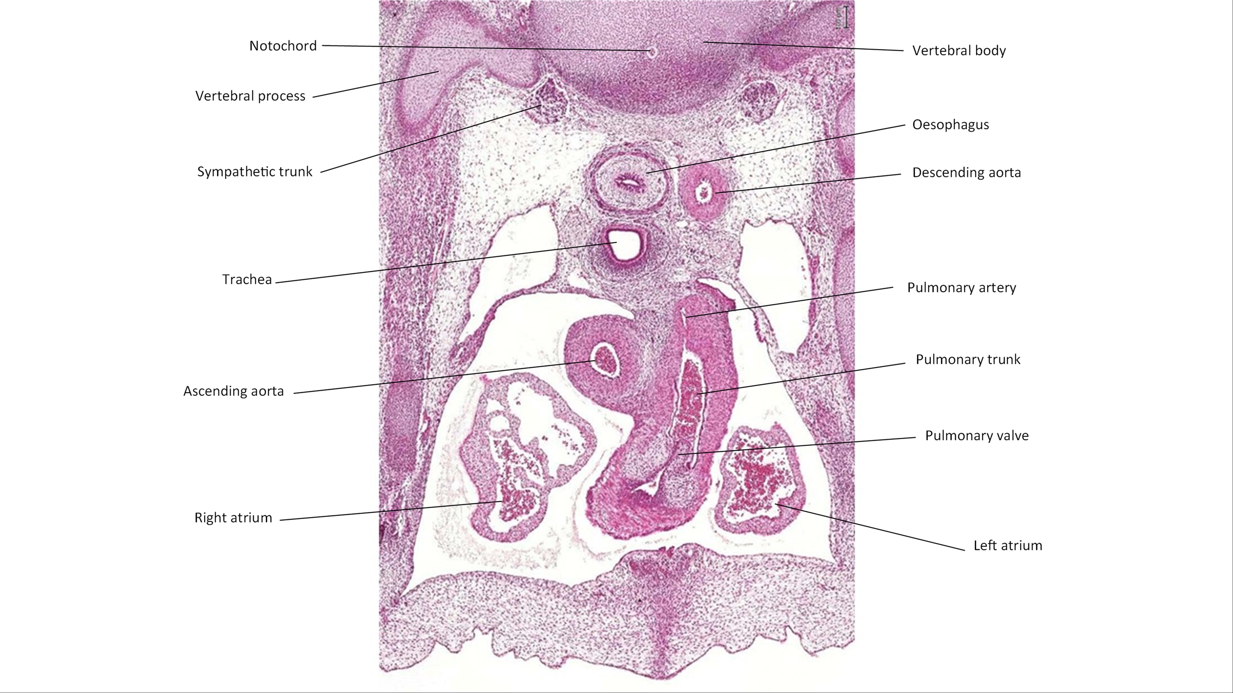 A histology section of a human embryo