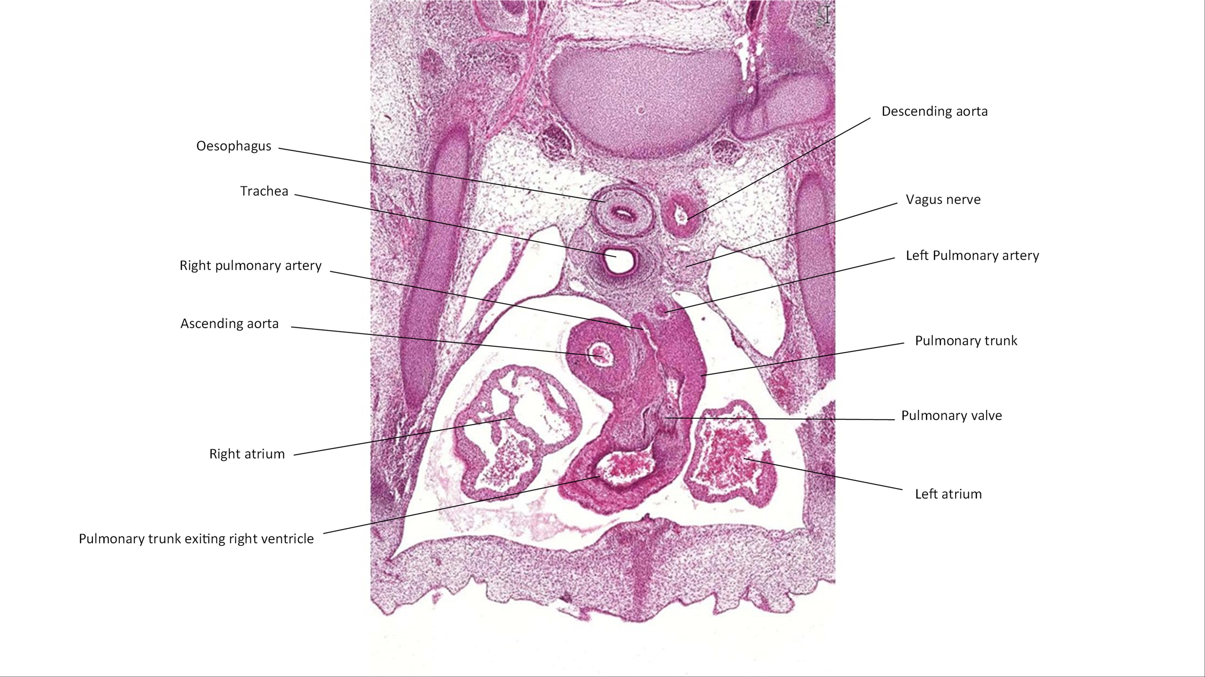 A histology section of a human embryo