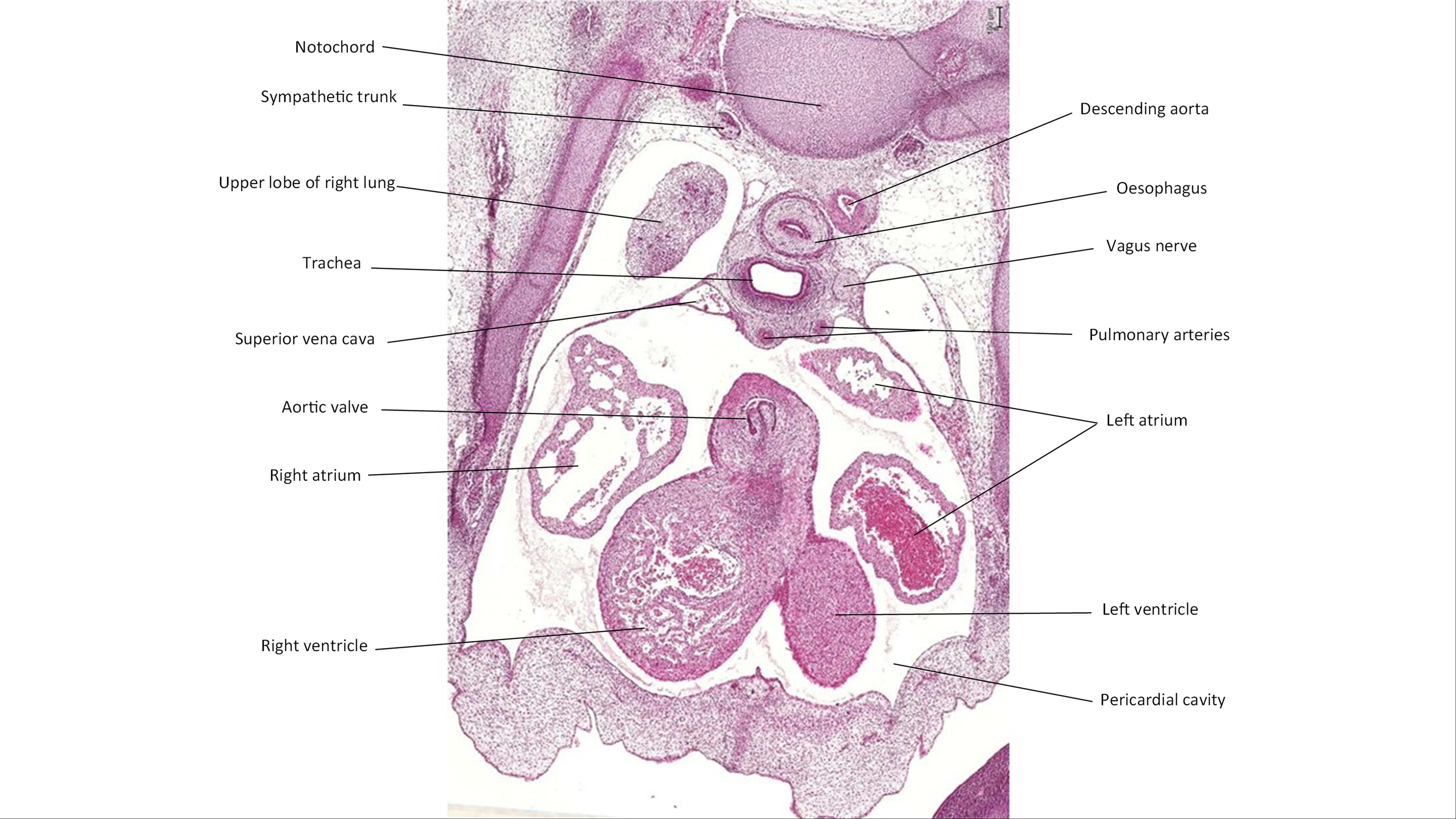 A histology section of a human embryo