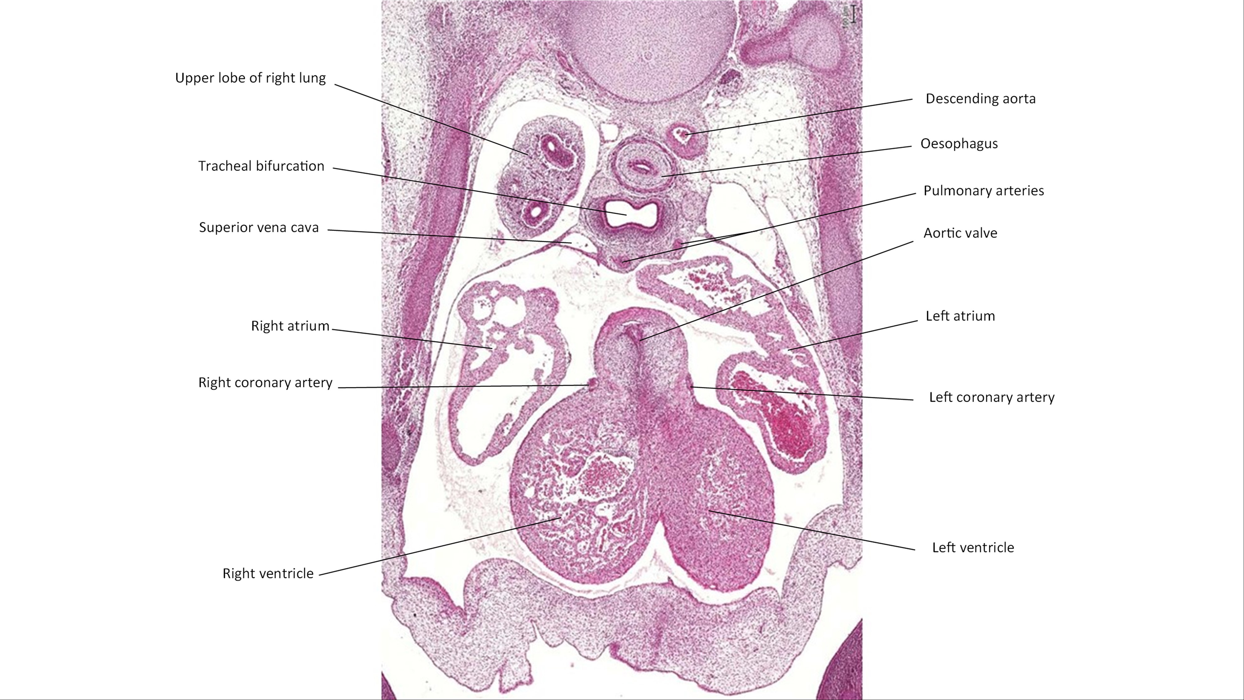 A histology section of a human embryo