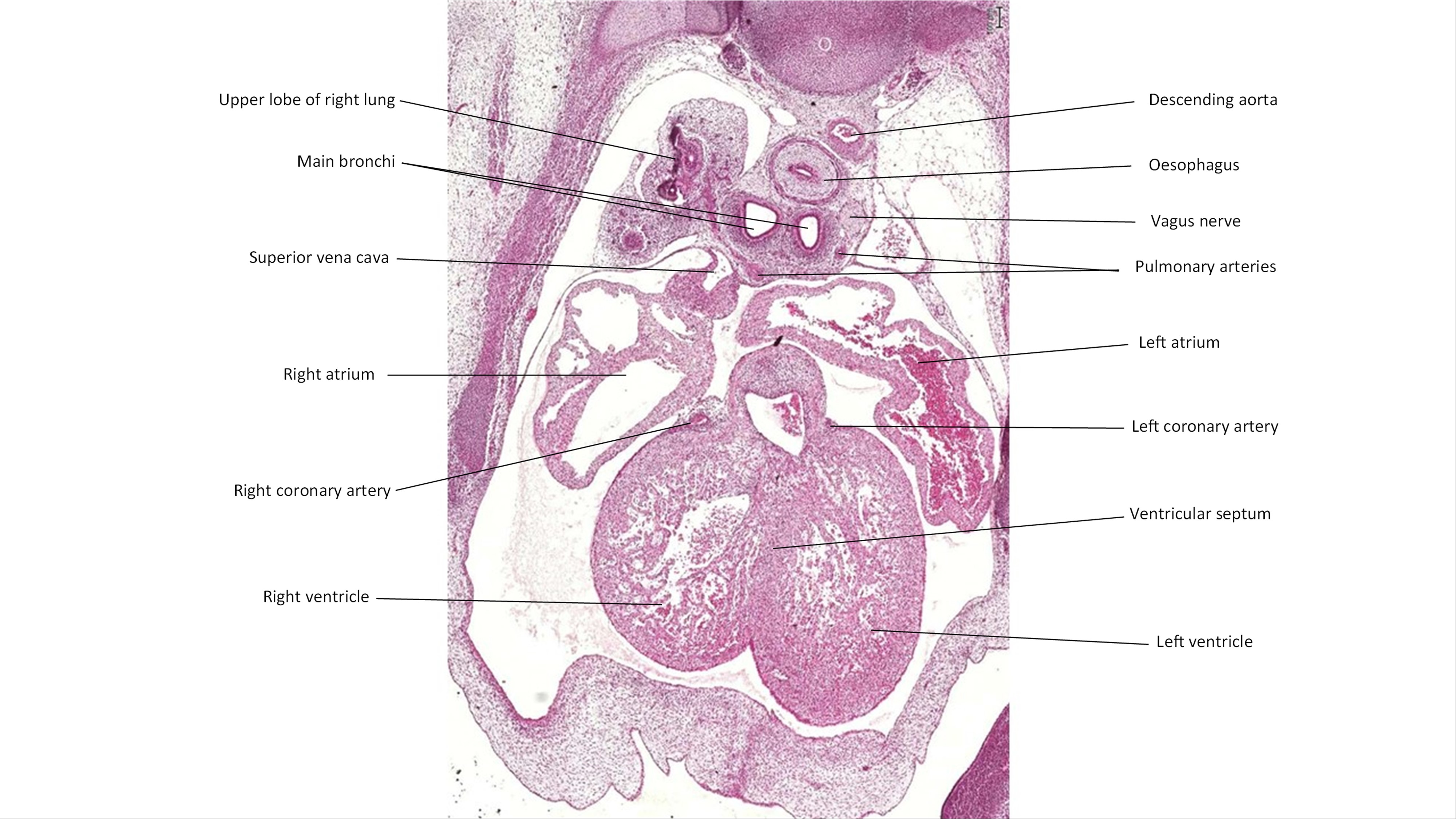 A histology section of a human embryo