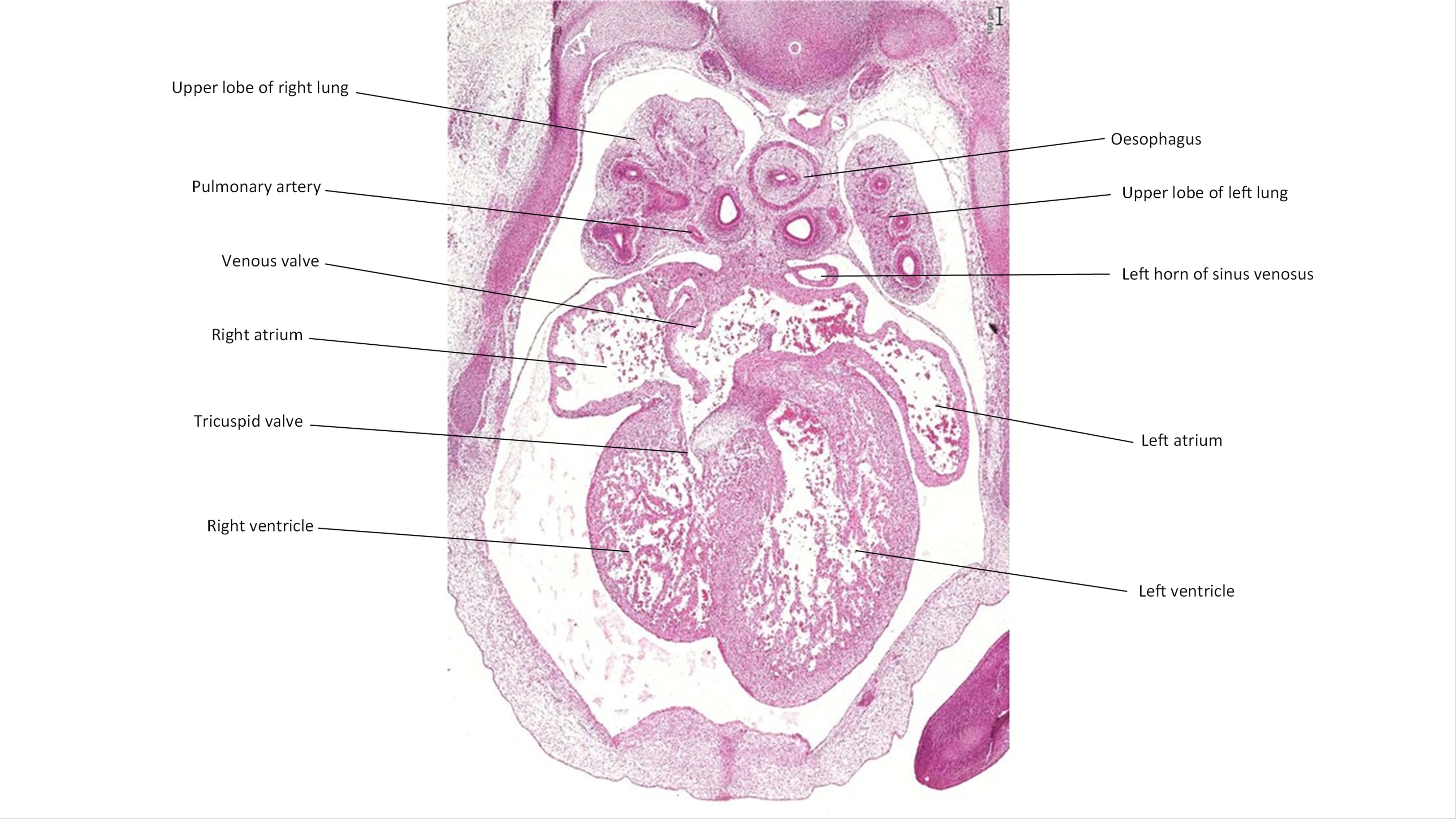 A histology section of a human embryo