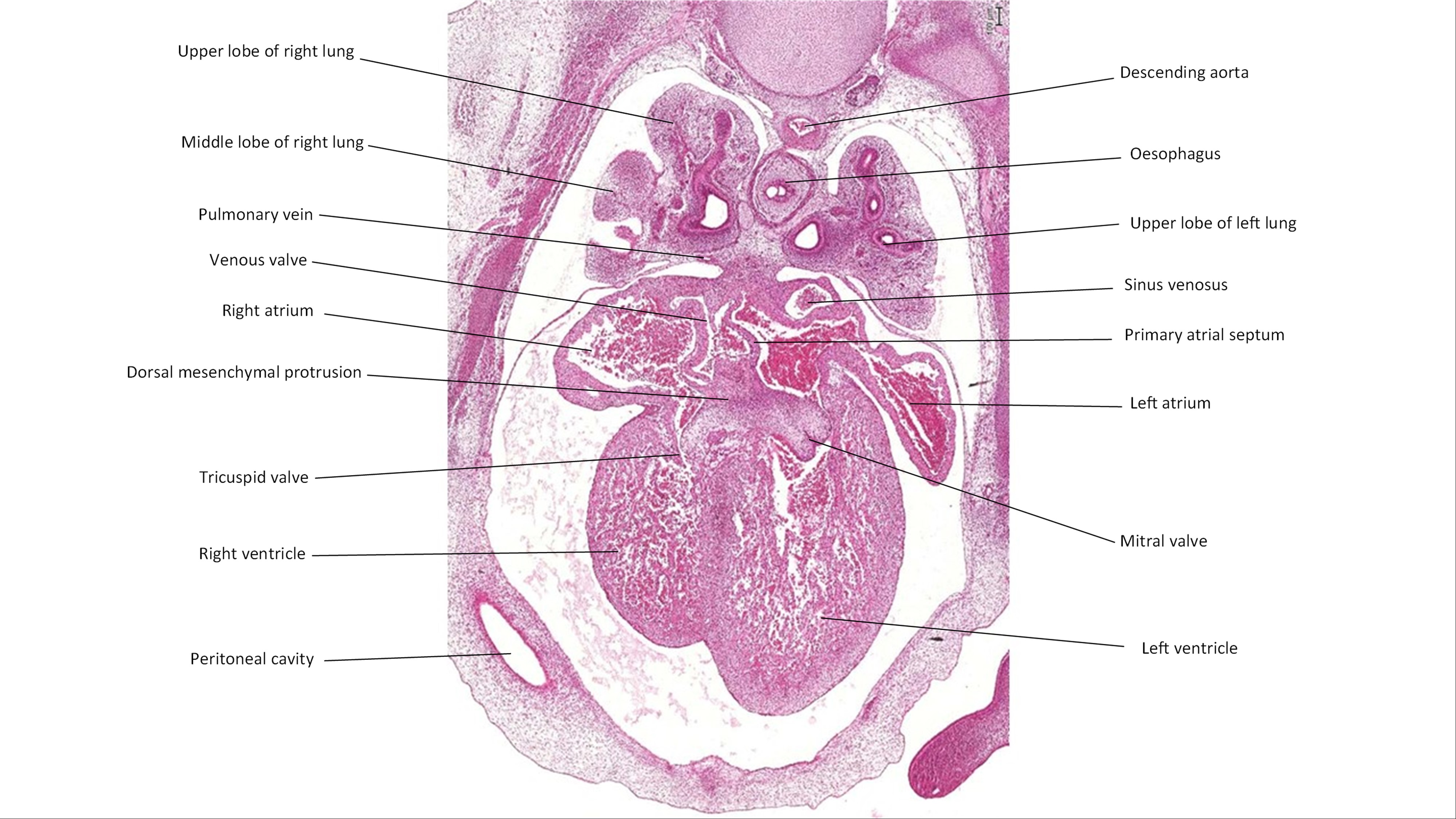 A histology section of a human embryo