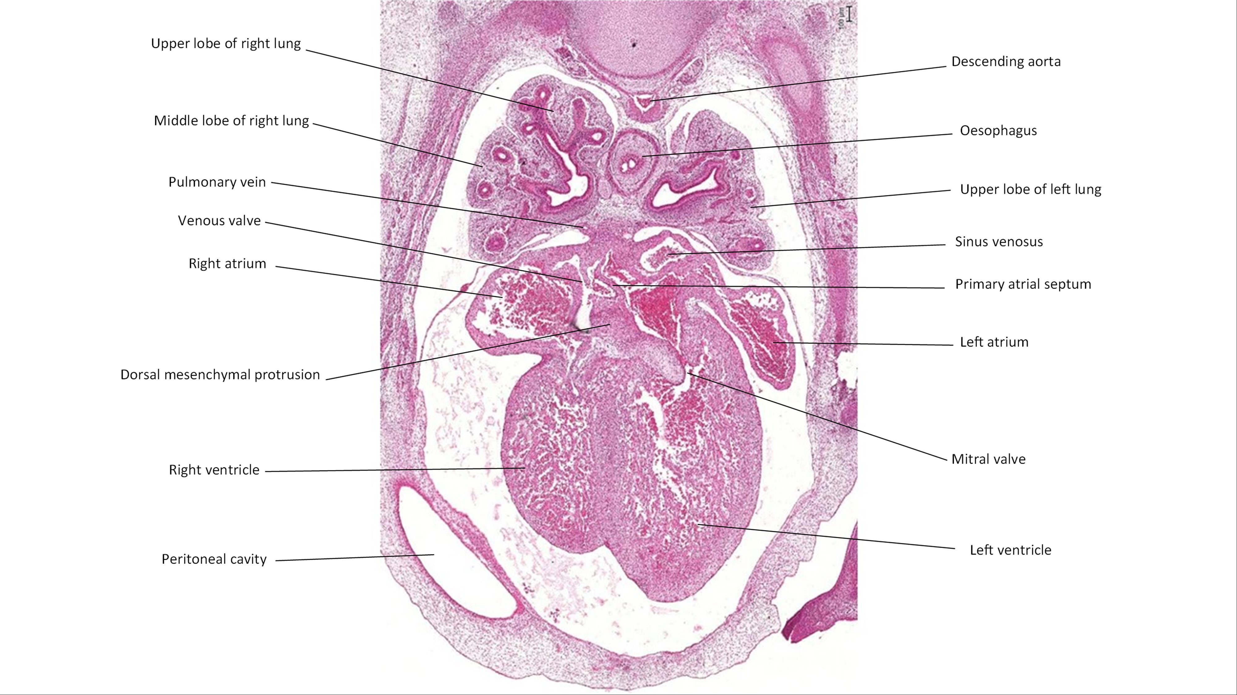 A histology section of a human embryo