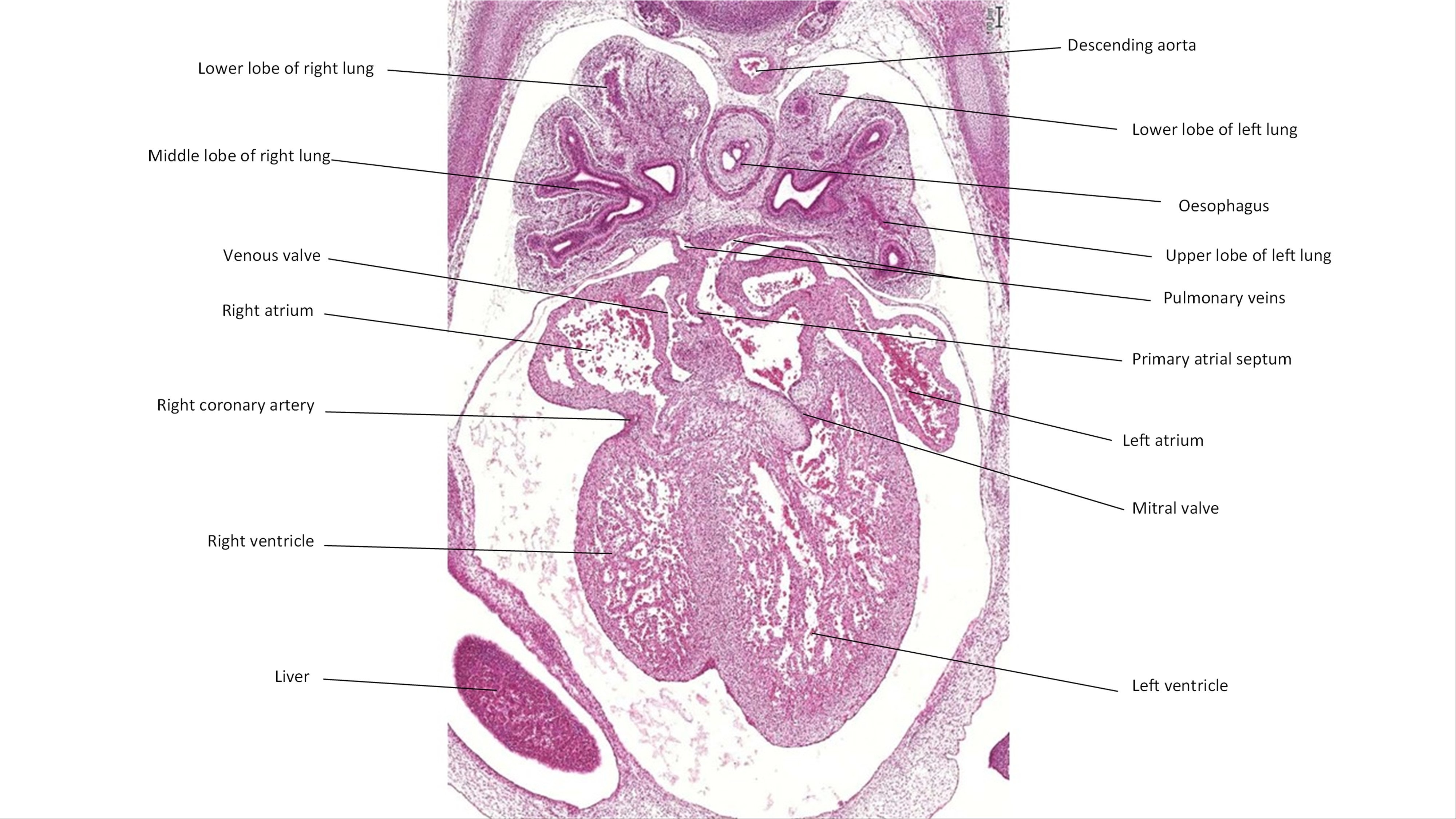 A histology section of a human embryo